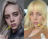 Did Billie Eilish Get a Breast Reduction?
