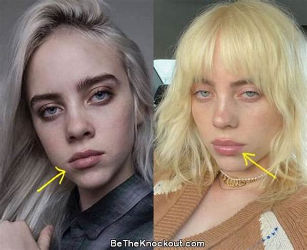 Did Billie Eilish Get a Breast Reduction?