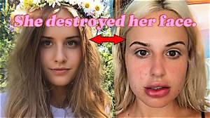 Did Blair Fleming Have Bottom Surgery? Details Explored