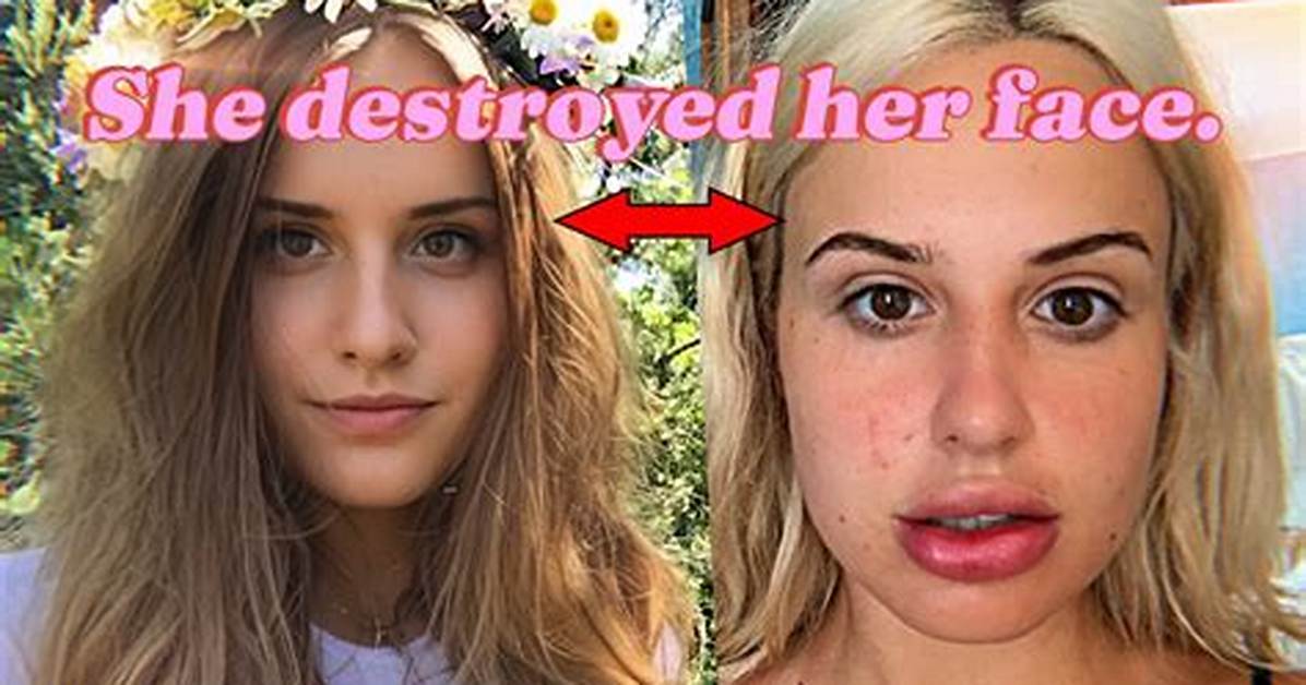 Did Blair Fleming Have Bottom Surgery