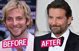 Did Bradley Cooper Get Plastic Surgery? Who Is Bradley Cooper?