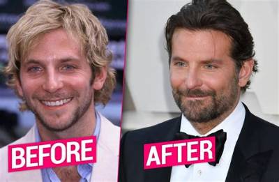 Did Bradley Cooper Get Plastic Surgery? Who Is Bradley Cooper?