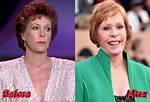 Did Carol Burnett Have Plastic Surgery? Uncovering the Truth