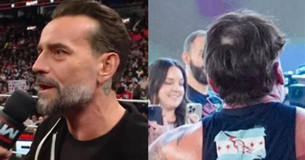 Did Cm Punk Get a Hair Transplant? Exploring the Facts and Myths