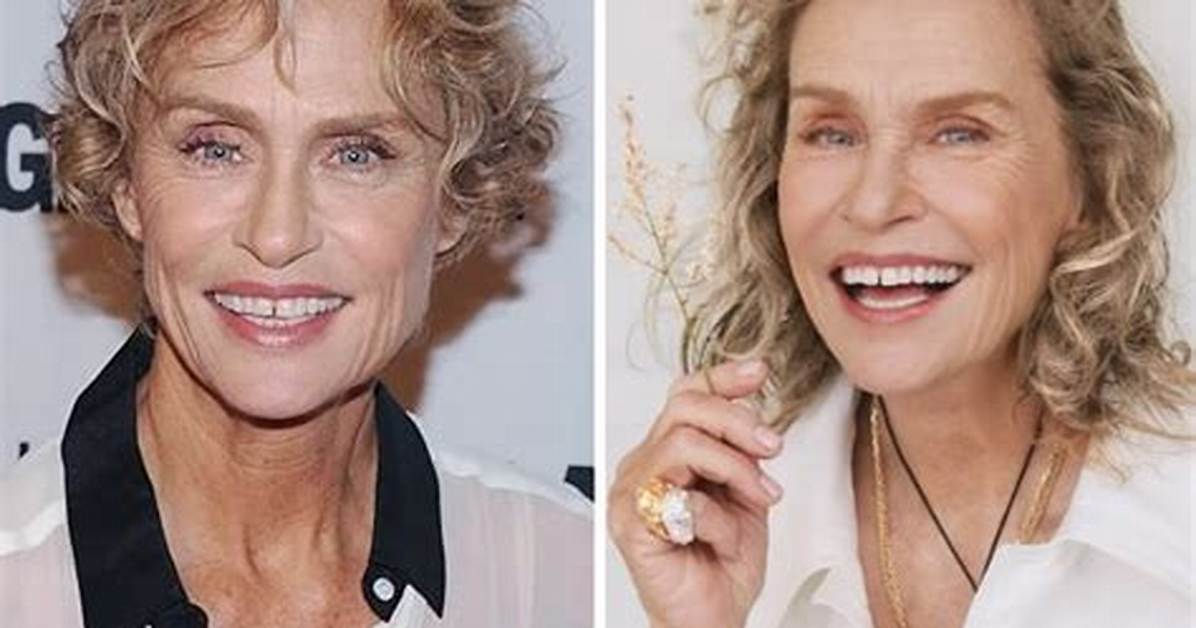 Did Lauren Hutton Get Her Teeth Fixed?