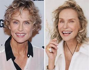 Did Lauren Hutton Get Her Teeth Fixed?