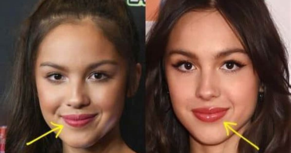 Did Olivia Rodrigo Get Breast Implants Before and After Plastic Surgery