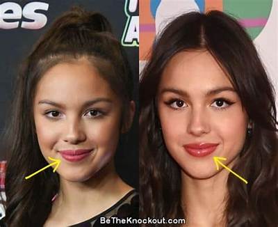 Did Olivia Rodrigo Get Breast Implants? Before and After Plastic Surgery Photos Compared