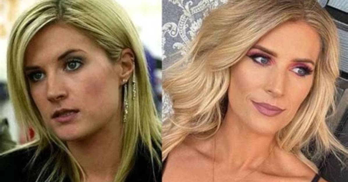 Did Sarah Jayne Dunn Get Her Lips Done? Plastic Surgery Before and After