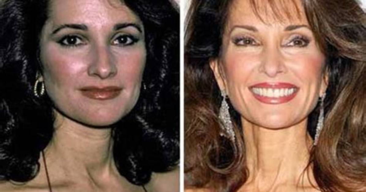 Did Susan Lucci Undergo Plastic Surgery? Who Exactly Is Susan Lucci? - Sarkariresult