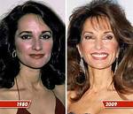 Did Susan Lucci Undergo Plastic Surgery? Who Exactly Is Susan Lucci? - Sarkariresult