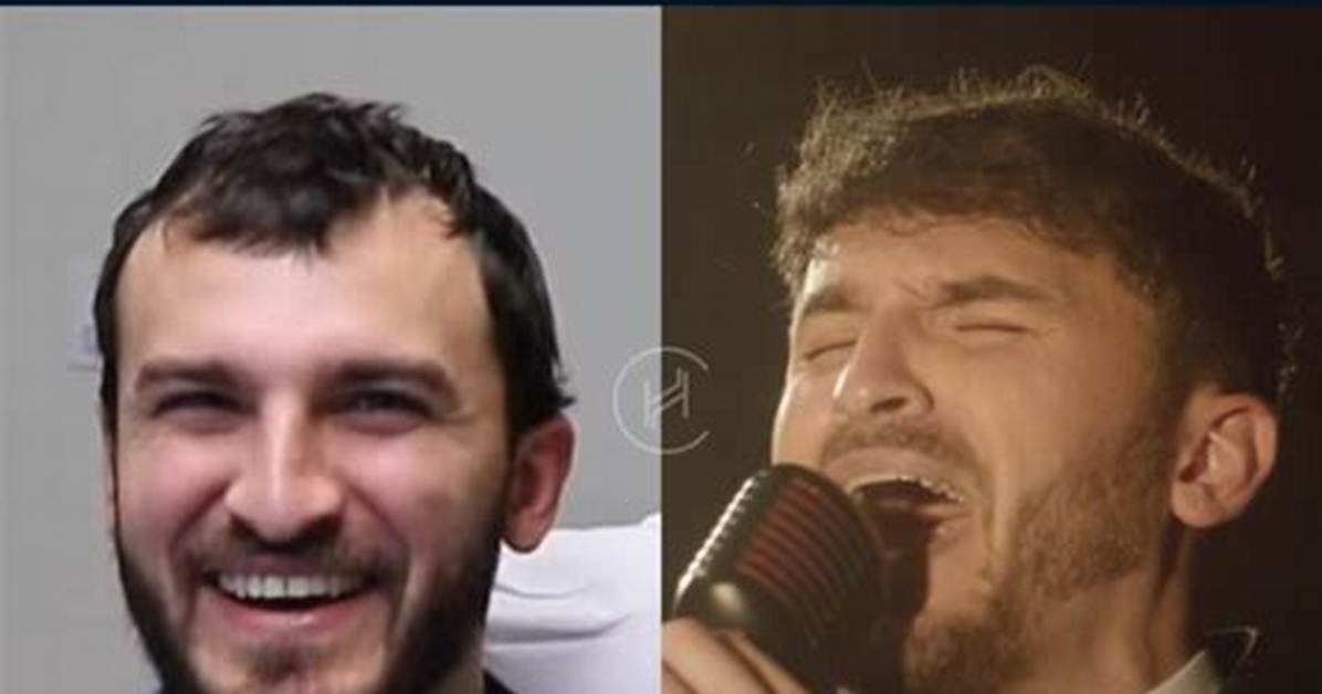 Did Zane Hijazi Just Get Hair Surgery and If Yes, Why?