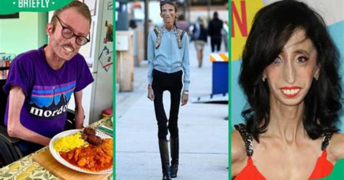 Discovering the Skinniest Man in the World: a Fascinating Journey