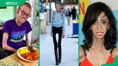 Discovering the Skinniest Man in the World: a Fascinating Journey