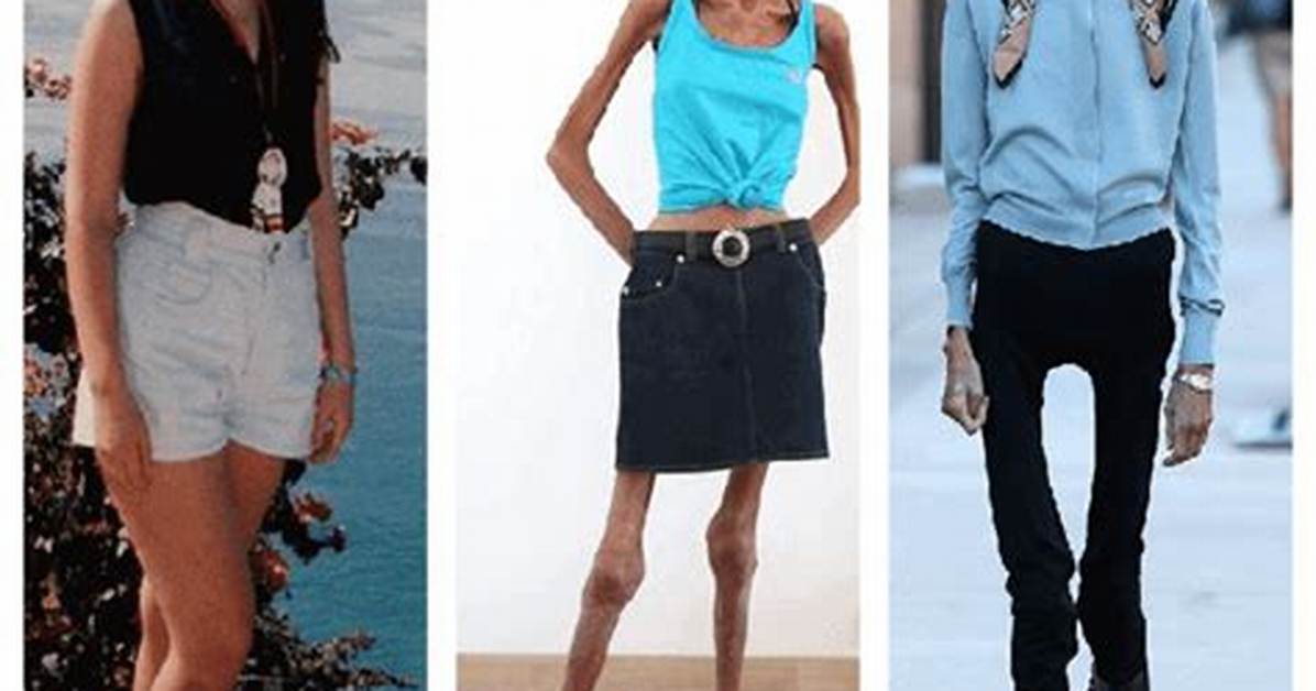 Discovering the Skinniest Person in the World: a Fascinating Look at Weight and Beyond