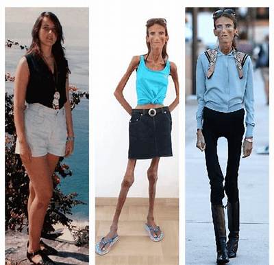 Discovering the Skinniest Person in the World: a Fascinating Exploration