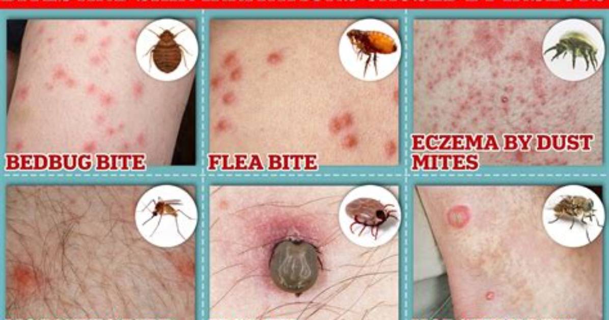 Do Bed Bugs Fight Each Other?