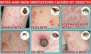 Do Bed Bugs Fight Each Other?