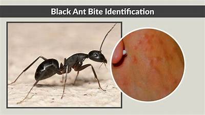 Do Black Ants Bite Itch?