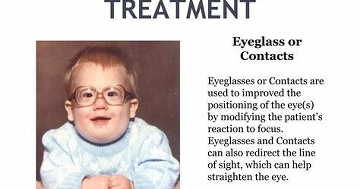 Do Contacts Help Strabismus?