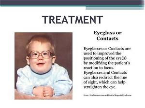 Do Contacts Help Strabismus?