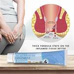 Do Creams Help External Hemorrhoids?