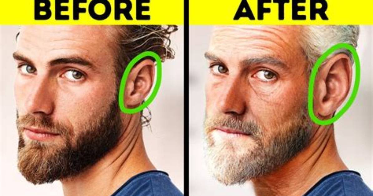 Do Ears Get Larger as You Age?
