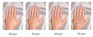 Do Fingers Thicken with Age?