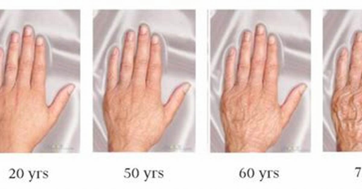 Do Hands Get Bigger with Age?