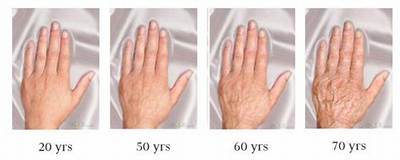 Do Hands Get Bigger with Age?