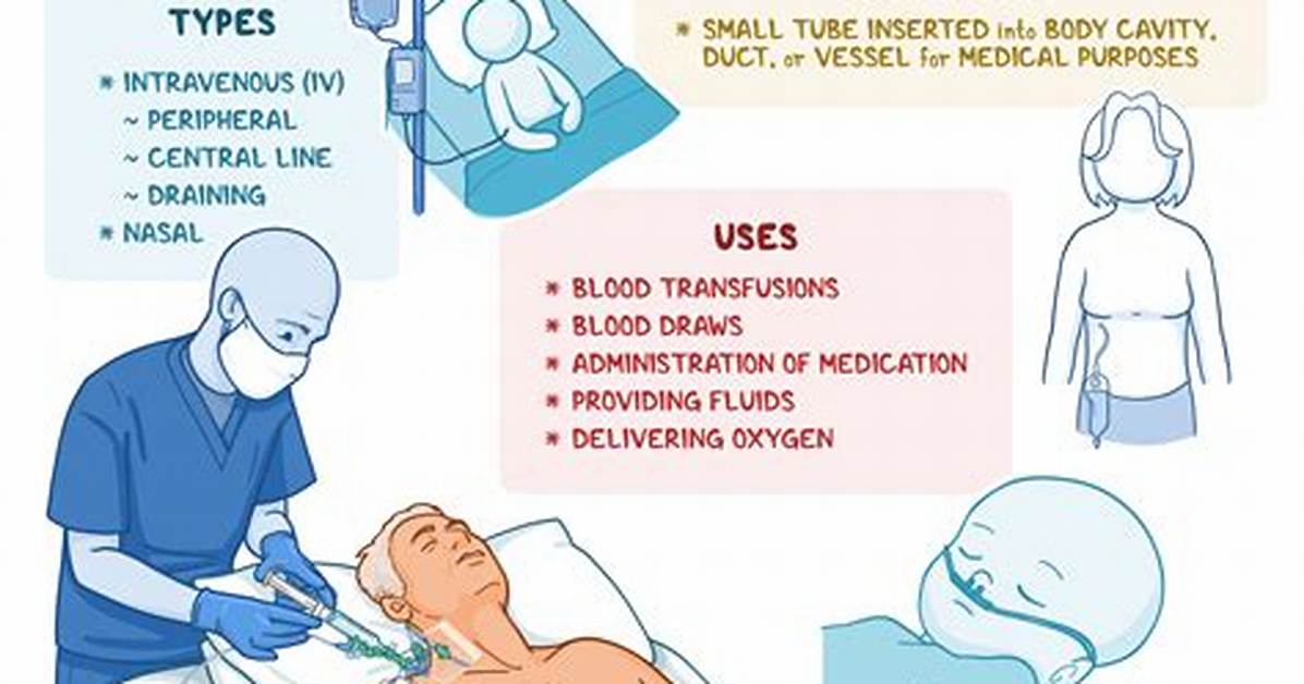 Do Nurses Put in Cannulas Uk?
