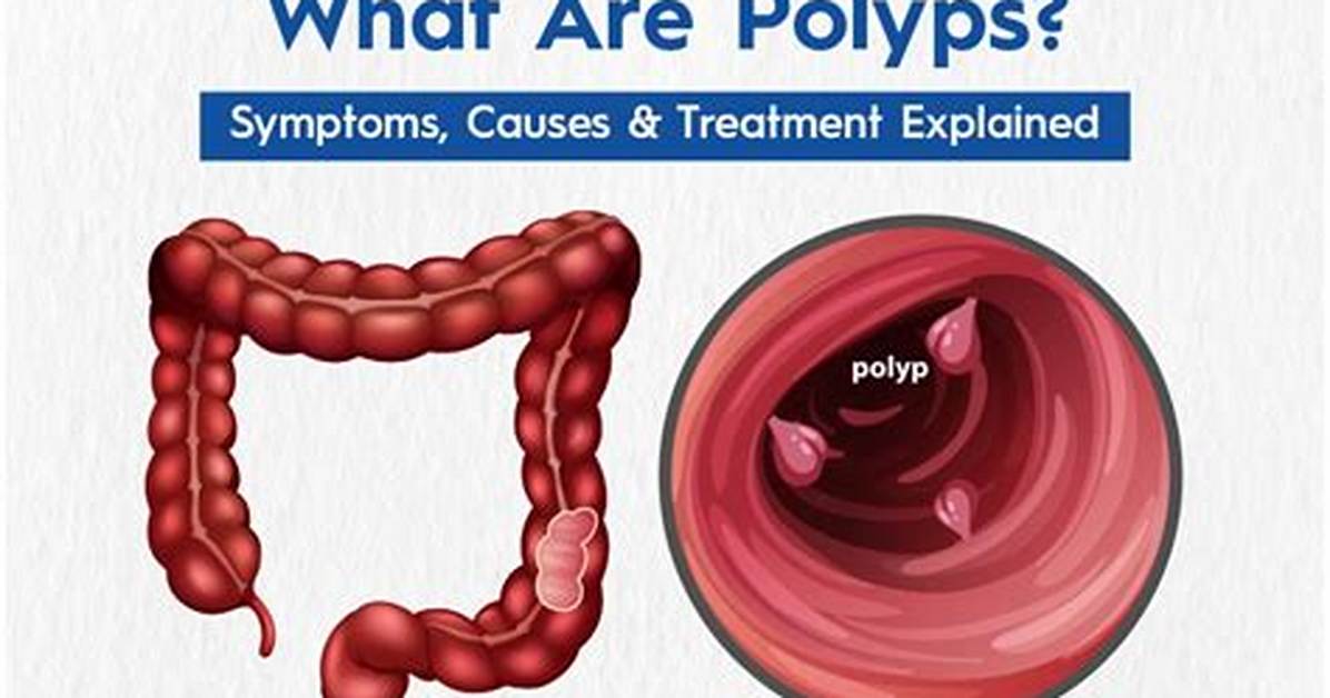 Do Polyps Cause Cramping?