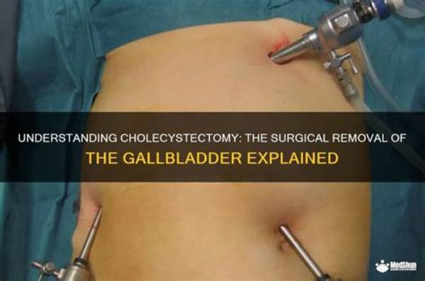 Do They Take out Appendix with Gallbladder?