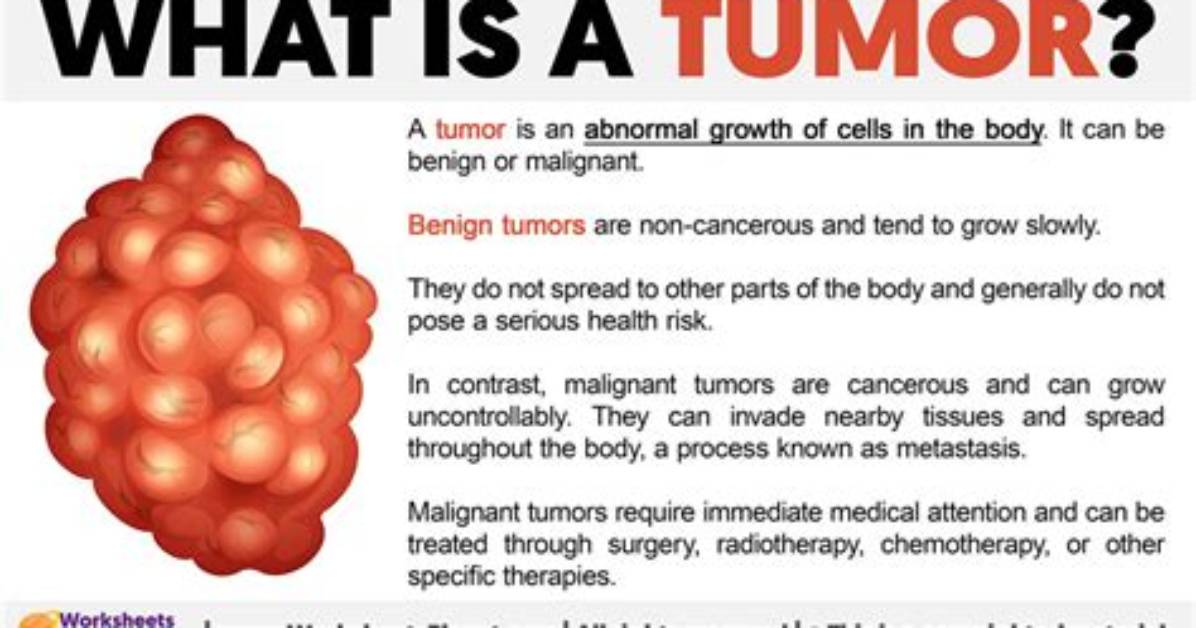 Do Tumors Go Away with Radiation?