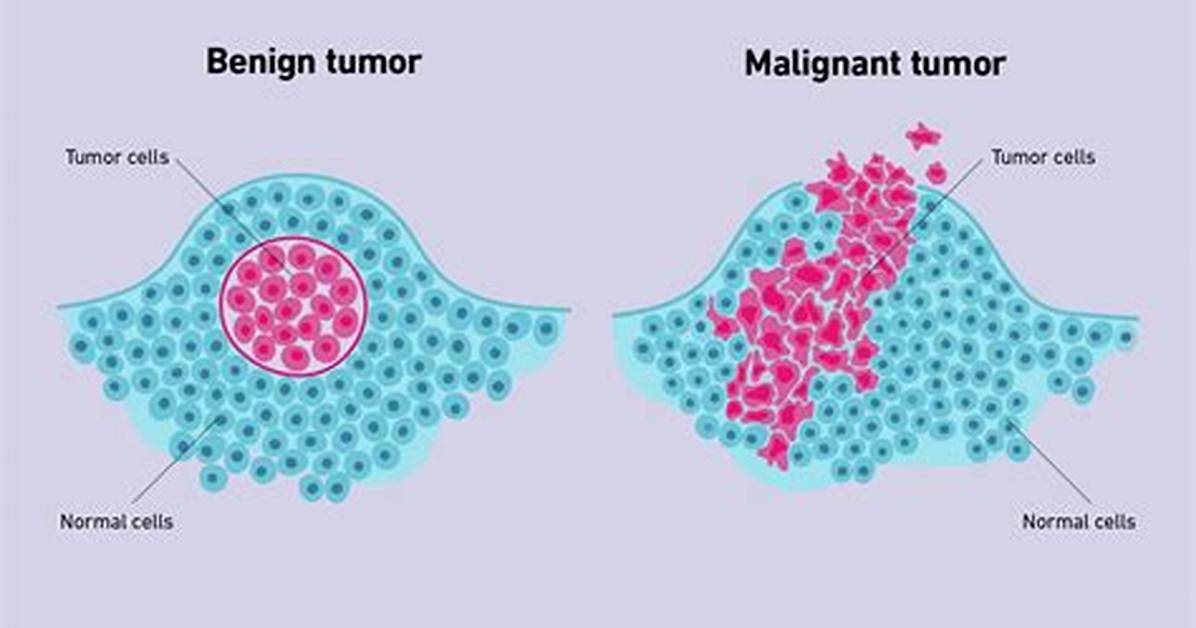 Do Tumors Weigh Anything?