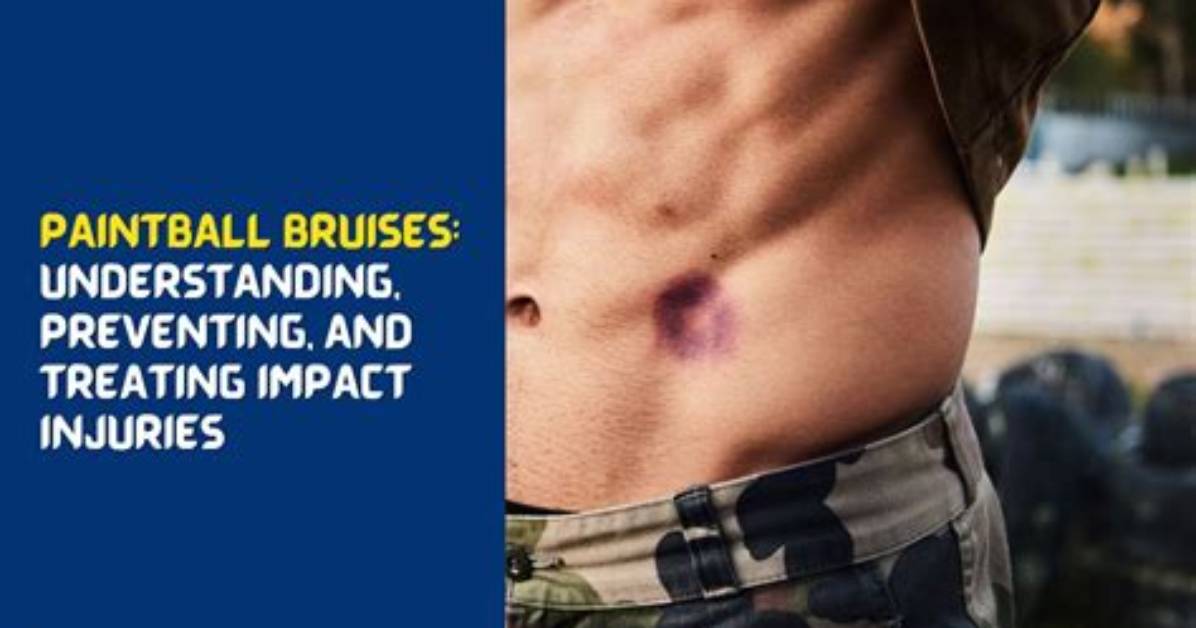 Do You Get Bruises from Paintball?