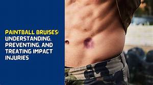 Do You Get Bruises from Paintball?