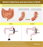 Do You Get Diarrhea When Dehydrated?