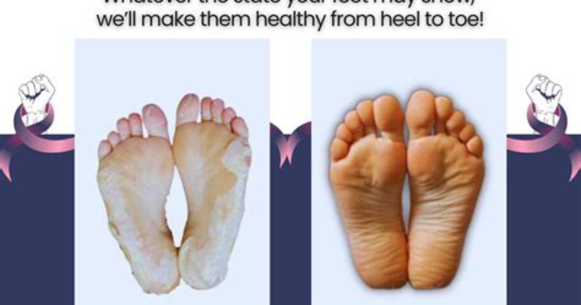 Do Your Feet Have to Be Set for a Charge?