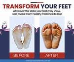Do Your Feet Have to Be Set for a Charge?