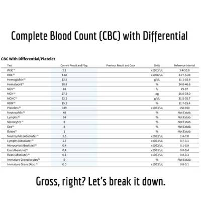 Does a Normal Cbc Rule out Leukemia?