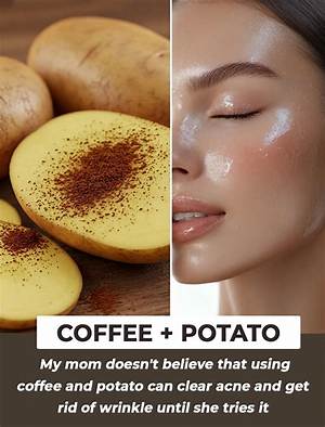 Does a Potato Get Rid of Wrinkles?