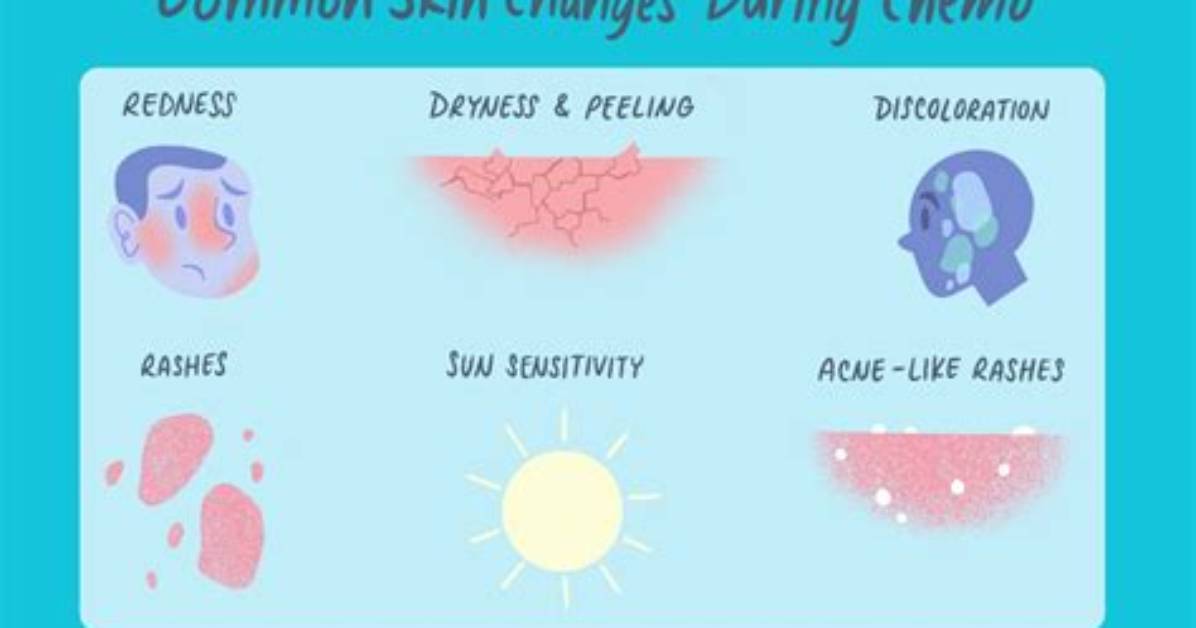 Does Chemo Cause Flushed Face?