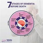 Does Dementia Kill You?