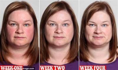 Does Drinking Make Your Face Fat?