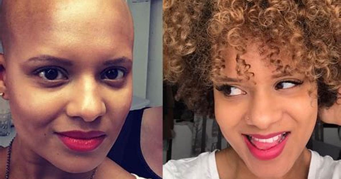 Does Everyone Get Curly Hair After Chemo?