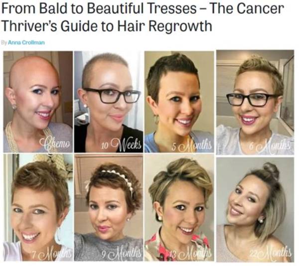 Does Everyone Lose Their Hair on Chemo?