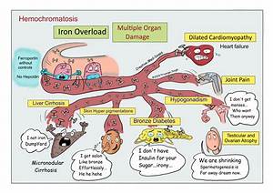 Does Hemochromatosis Cause Restless Legs?
