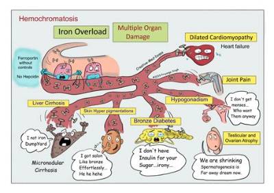 Does Hemochromatosis Cause Restless Legs?