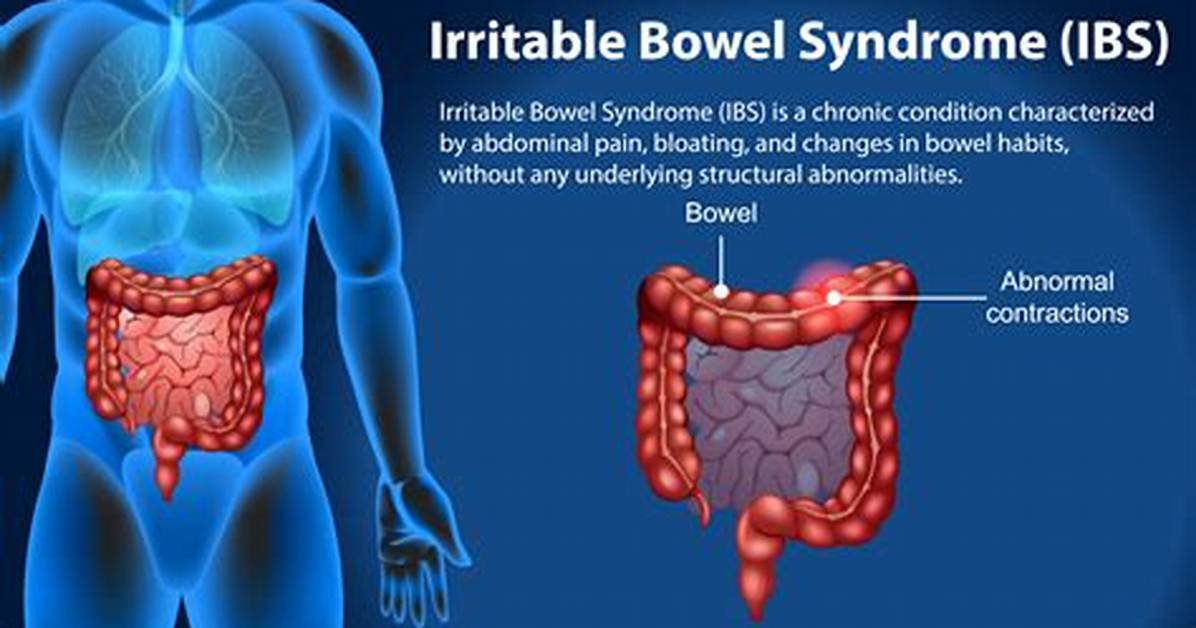 Does Ibs Shorten Your Life?
